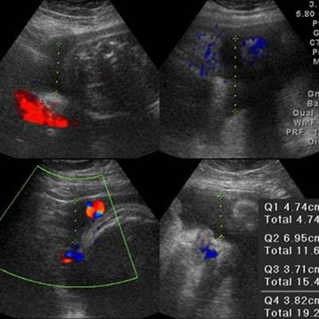 37 weeks ultrasound image